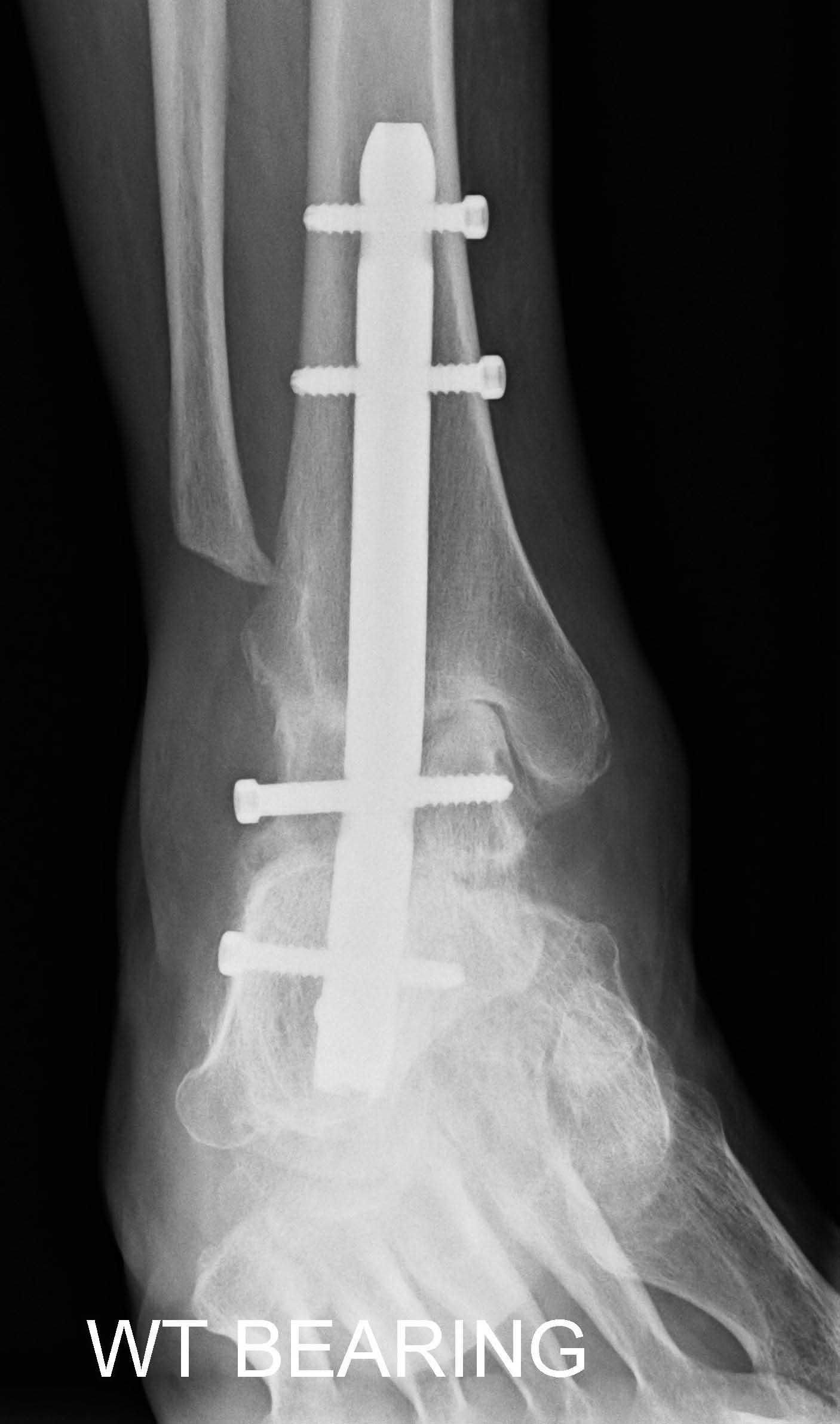 image-4