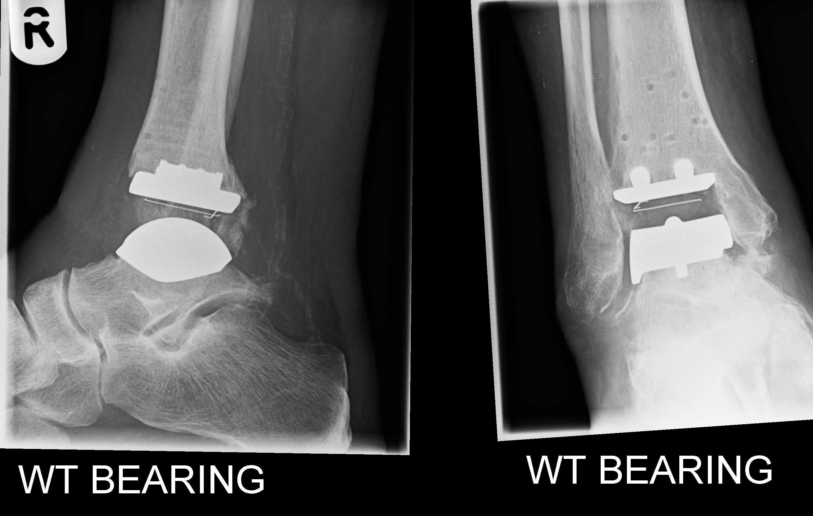 star-post-op
